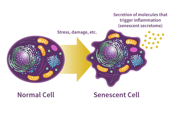 Stanična senescencija (starenje)