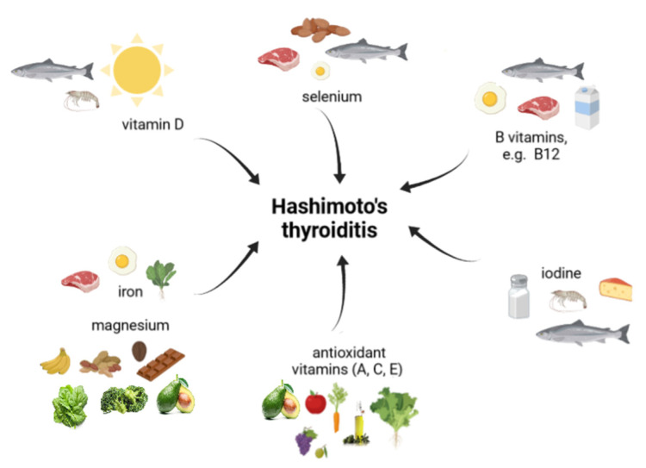 Hašimoto i prehrana